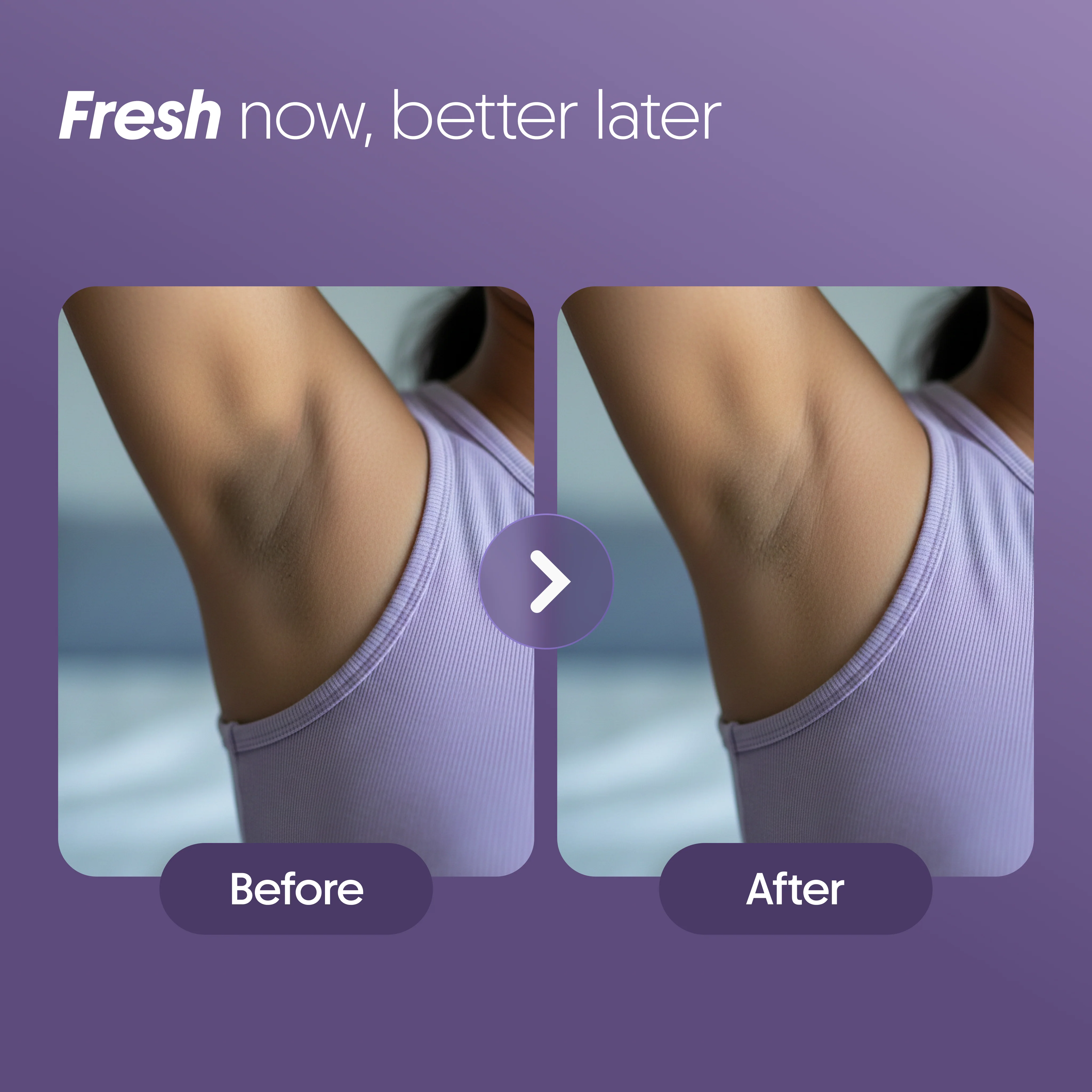 4% AHA BHA Underarm Roll-On - Aqua - Image 7