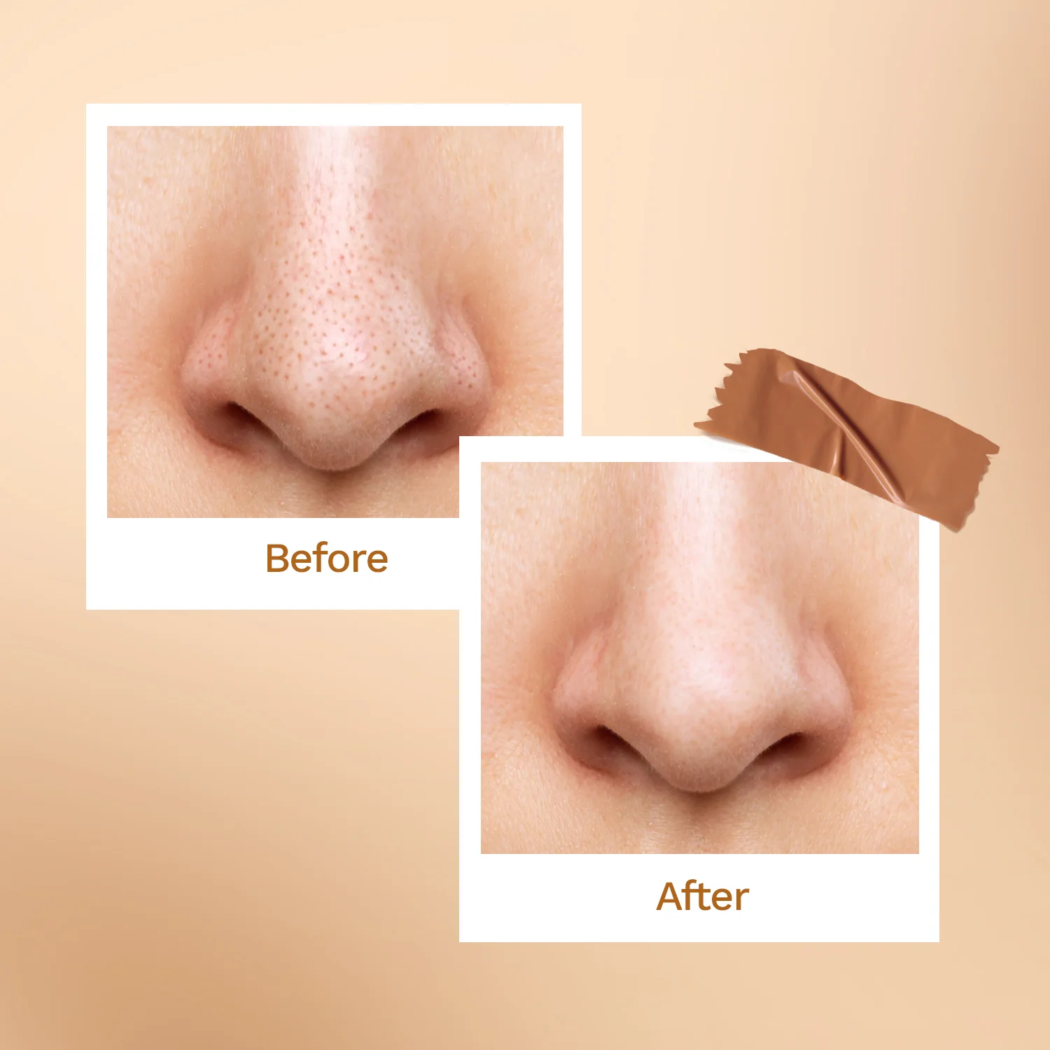 Bamboo Charcoal Nose Strips (3N) - Image 12