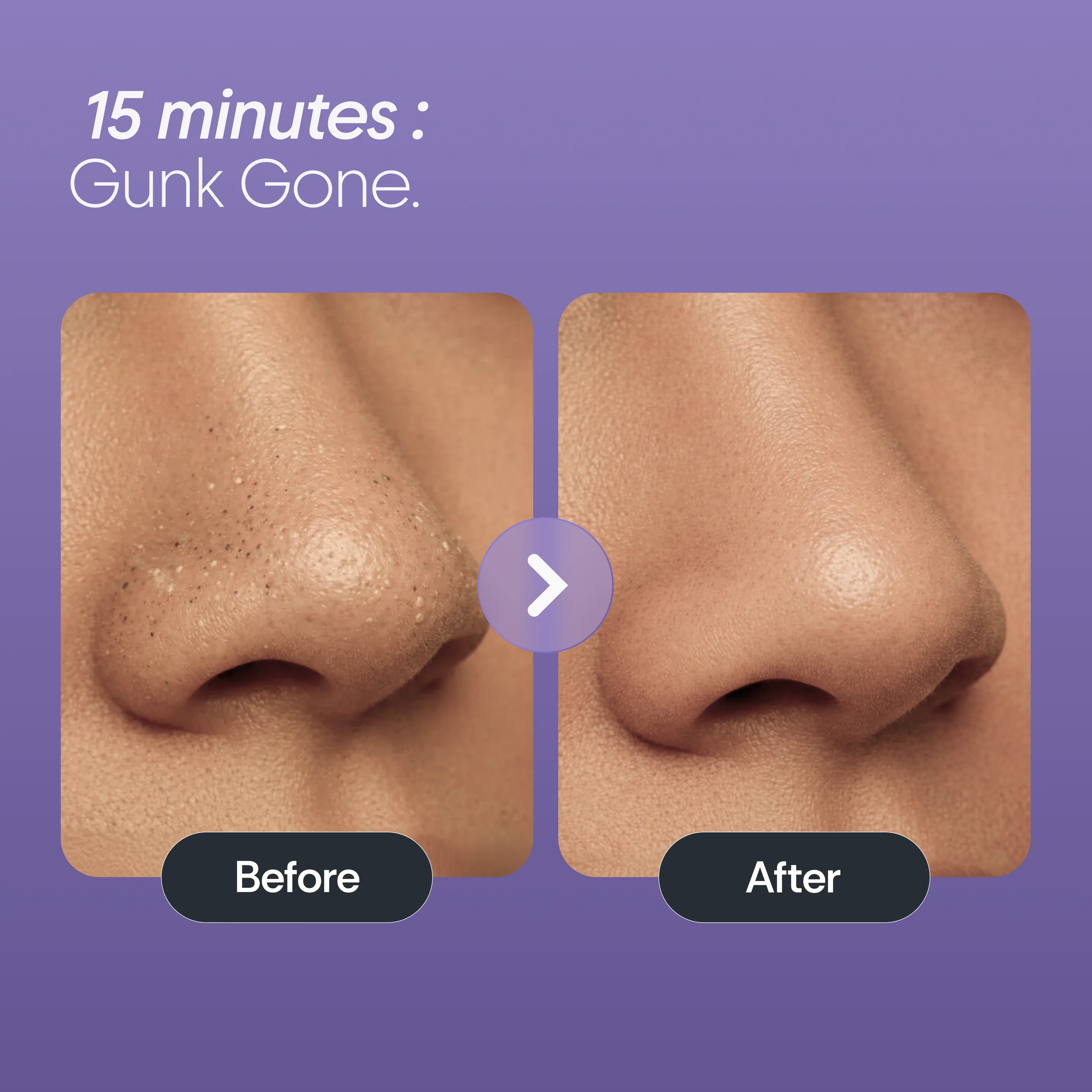 Bamboo Charcoal Nose Strips (3N) - Image 5