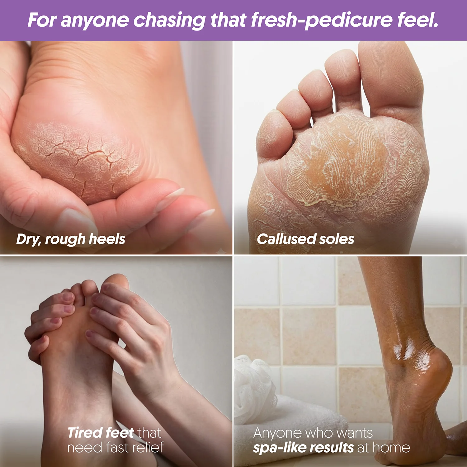 FURR Foot Rejuvenation Kit - Image 5