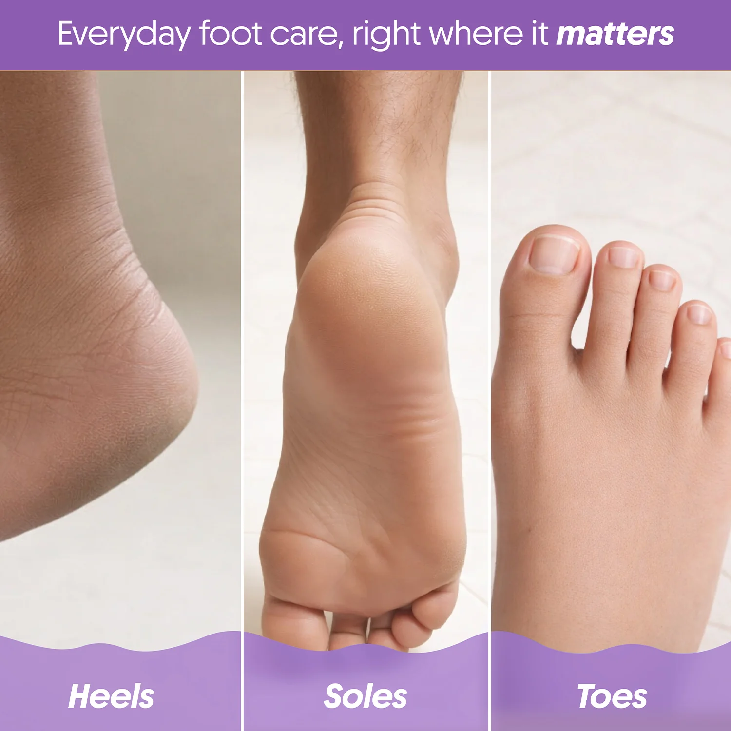 FURR Foot Rejuvenation Kit - Image 6